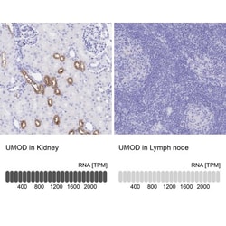 Uromodulin Antibody, Novus Biologicals 0.1mL; Unlabeled:Antibodies, Polyclonal